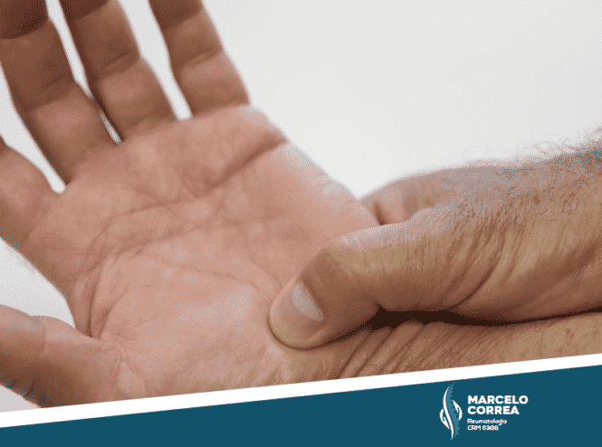 homem apertando a mão com reumatismo - site Dr. Marcelo Corrêa Reumatologista