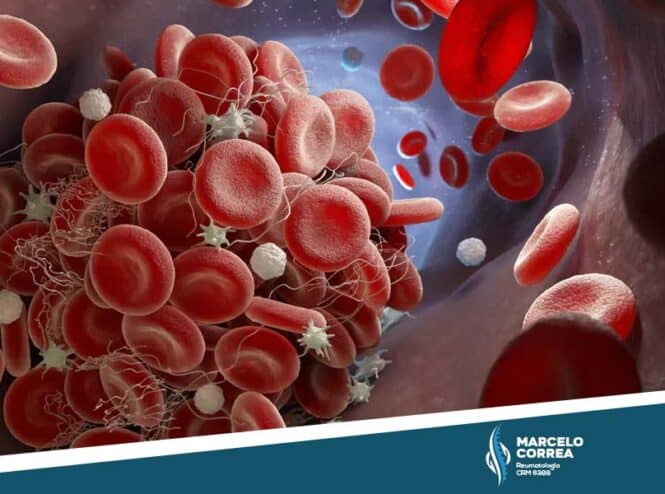 ilustração de células sanguíneas com síndrome antifosfolípide - Dr Marcelo Corrêa Reumatologista - site Dr. Marcelo Corrêa reumatologista