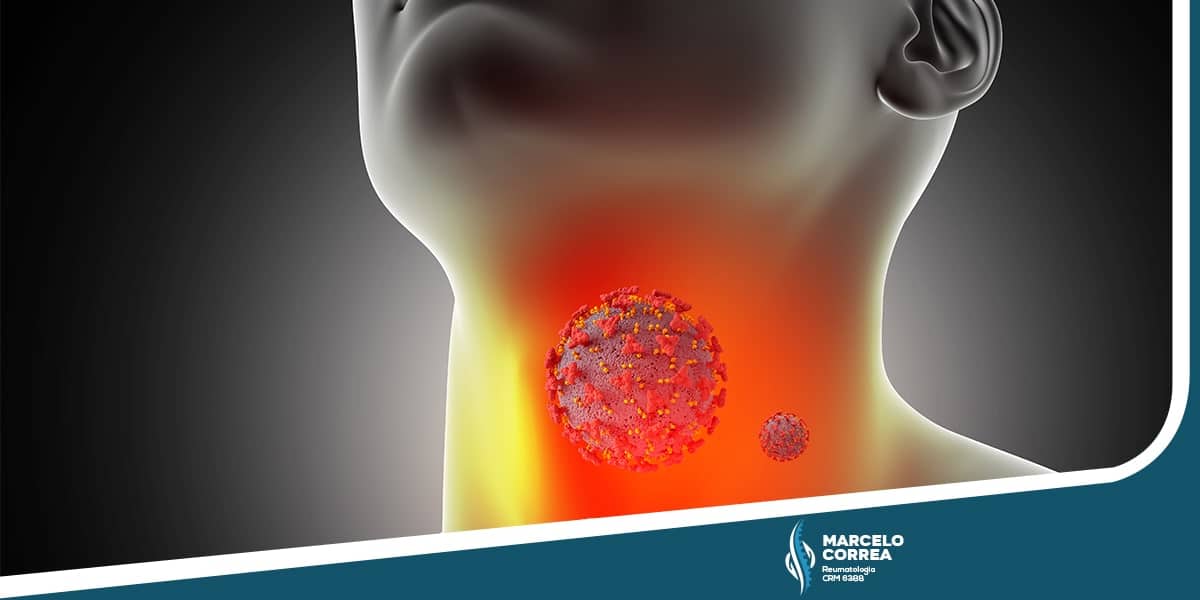 ilustração de pessoa com dor na garganta por febre reumática - site Dr. Marcelo Corrêa reumatologista