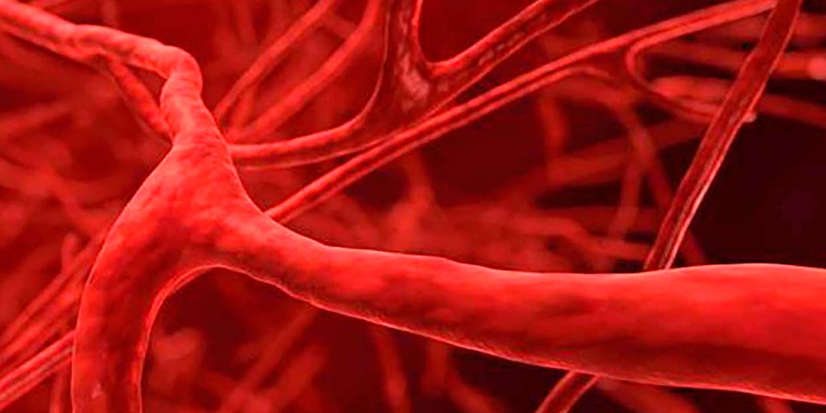 ilustração de vasos sanguíneos com vasculites