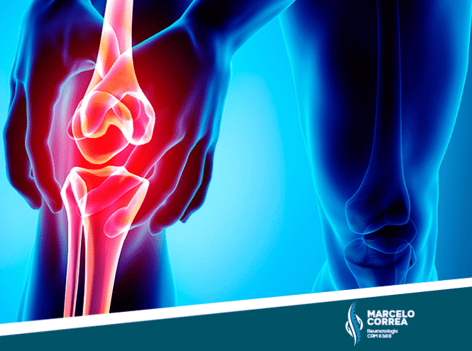 ilustração de homem tocando no joelho com osteoartrose - site Dr. Marcelo Corrêa