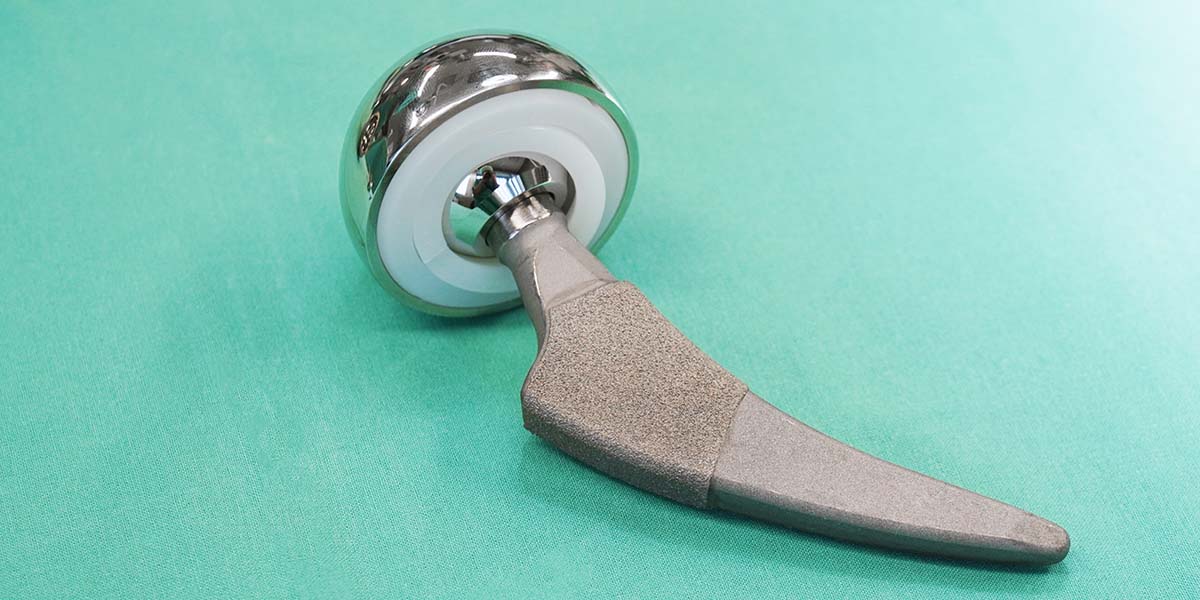 Protese para problemas articulares - site Dr. Marcelo Correa - Reumatologista em Belém - PA